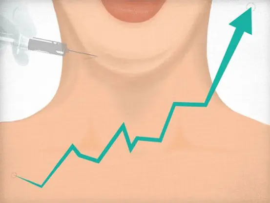 Kybella® in Poughkeepsie, NY