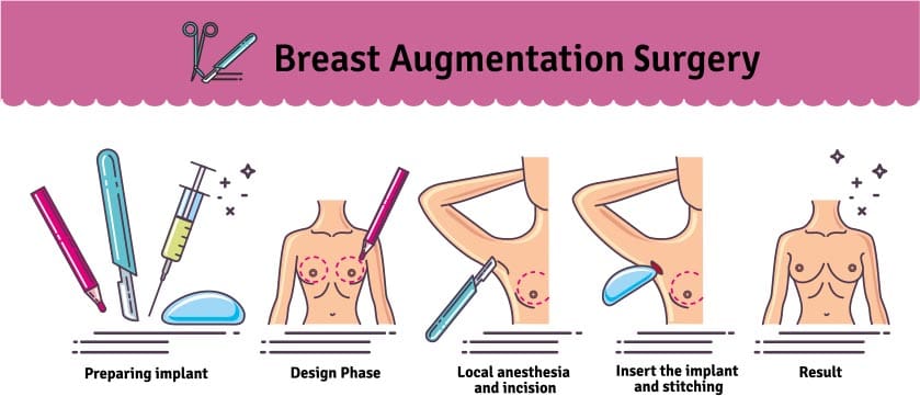 Breast Augmentation in Poughkeepsie, NY