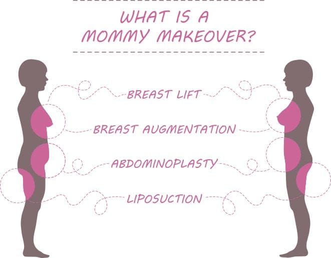 Mommy Makeover in Poughkeepsie, NY