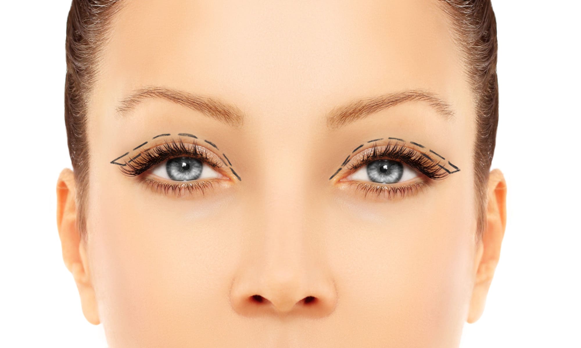 Eye Lift Blog post