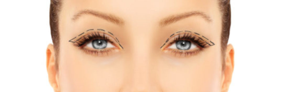 All About the Eye Lift in Poughkeepsie, NY